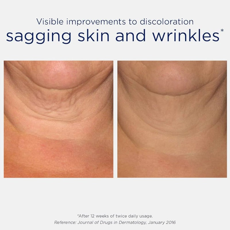 NEOSTRATA SKIN ACTIVE TRIPLE FIRMING NECK CREMA 80 g